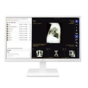 Vooraanzicht van 24&#34; All-in-One Thin Client voor de gezondheidszorg 24CK560N-3A