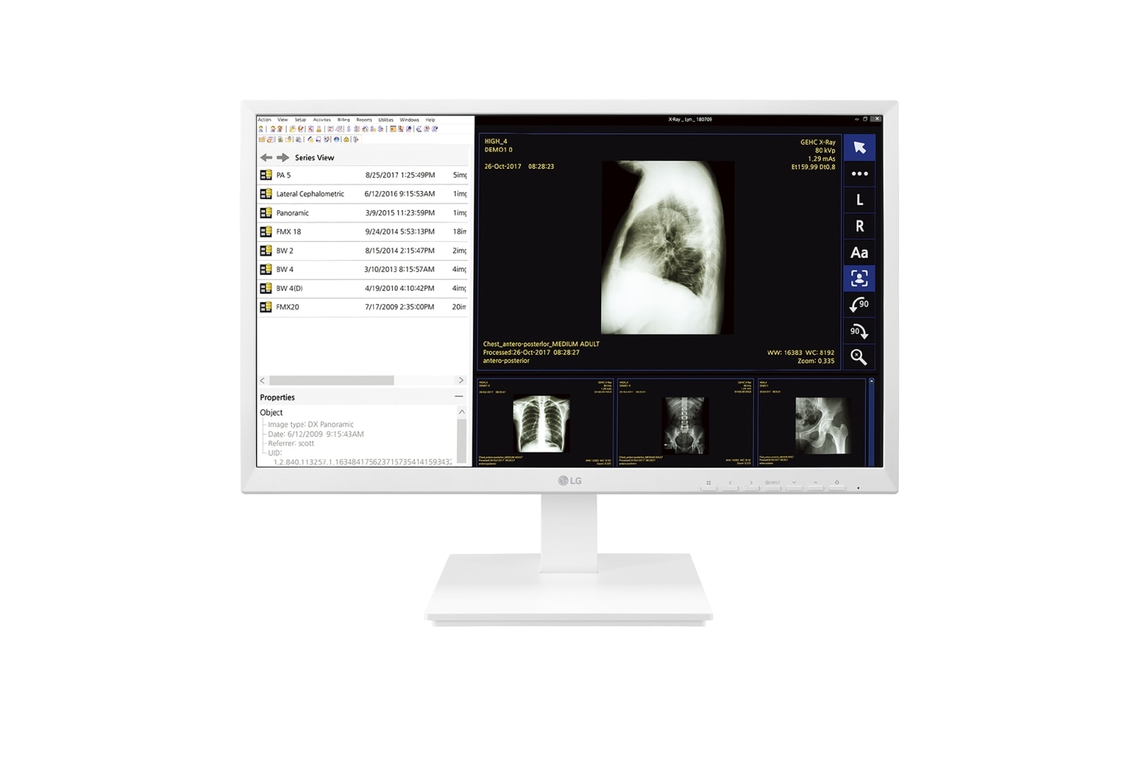 Vooraanzicht van 24&#34; All-in-One Thin Client voor de gezondheidszorg 24CK560N-3A