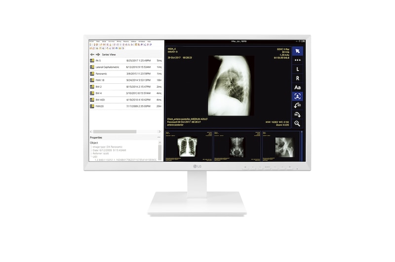 LG 24" All-in-One Thin Client voor de gezondheidszorg, 24CK560N-3A