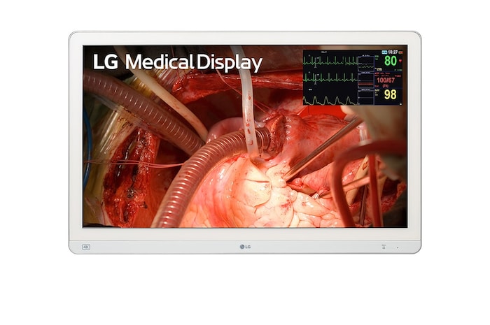 LG 27-inch 4K chirurgische monitor met Mini-LED, 27HQ710S-W