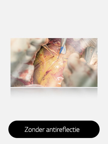 De afbeelding links toont een beeldscherm zonder antireflectie, met meer schittering en reflecties die het zicht beïnvloeden.