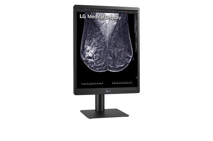 LG 21.3-inch 5MP IPS Diagnostische monitor for Mammography, 21HQ613D-B