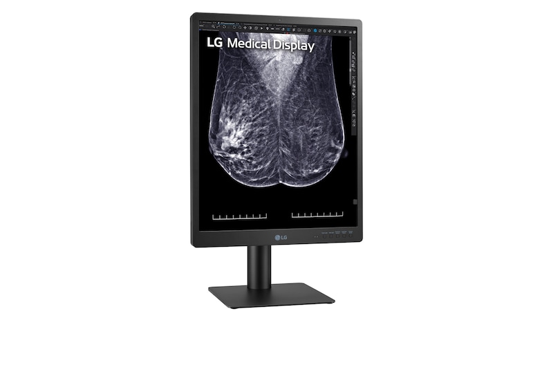 LG 21.3-inch 5MP IPS Diagnostische monitor for Mammography, 21HQ613D-B