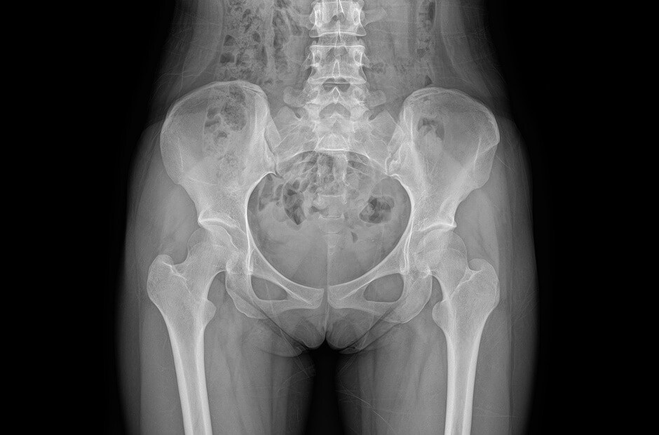 x-ray image 6.
