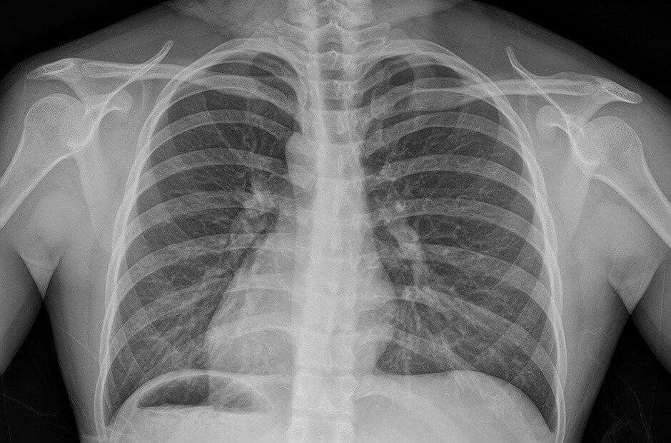 x-ray image 2.