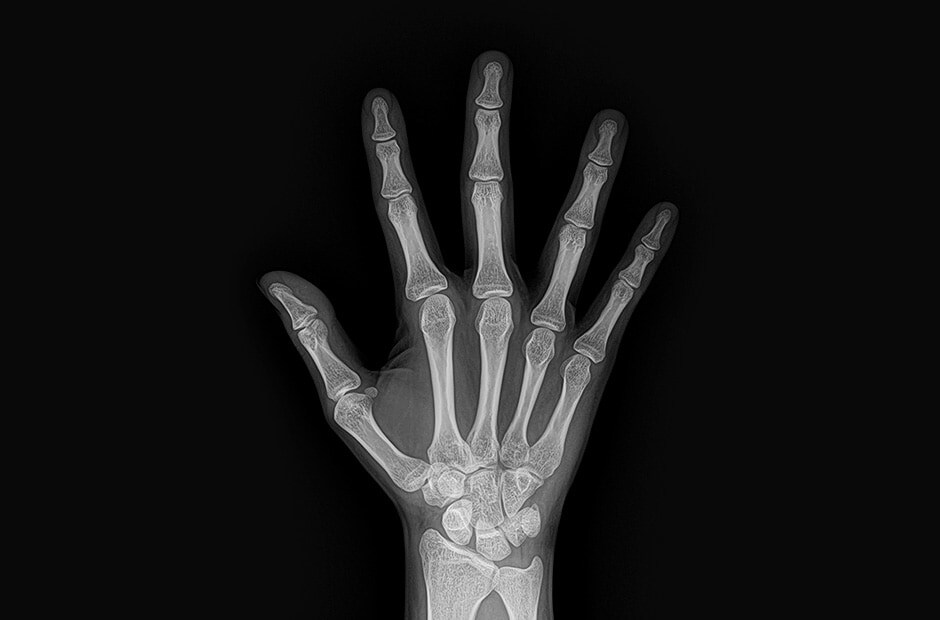 x-ray image 4.