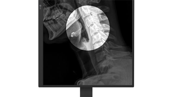 El 27HS713C cuenta con el Modo de Vista de Enfoque, que resalta partes específicas de la imagen médica. Los usuarios pueden seleccionar y enfocarse fácilmente en áreas de interés, mientras oscurecen el resto de la pantalla.