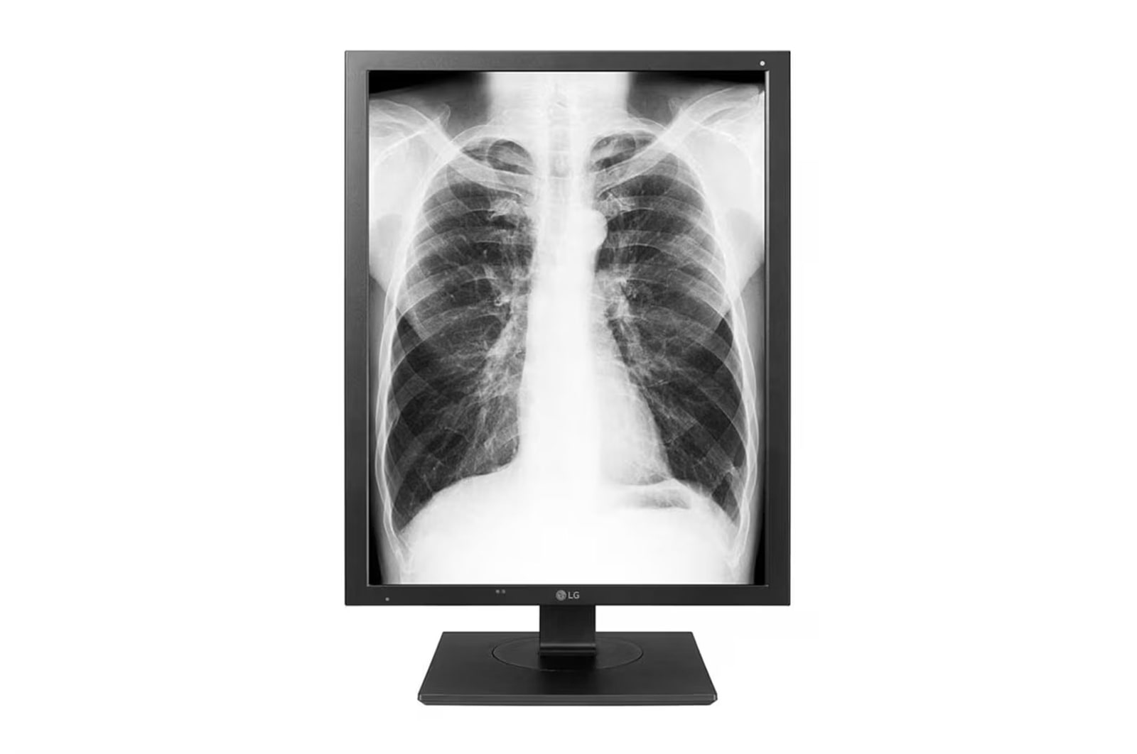 Front view of Monitor de diagnóstico LG de 3MP 21HQ513D-S