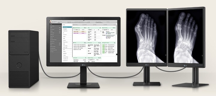 Puede conectar un 24HR513C con dos monitores de diagnóstico *3MP, mostrando los historiales de los pacientes en un 24HR513C y las imágenes médicas en dos monitores 3MP.