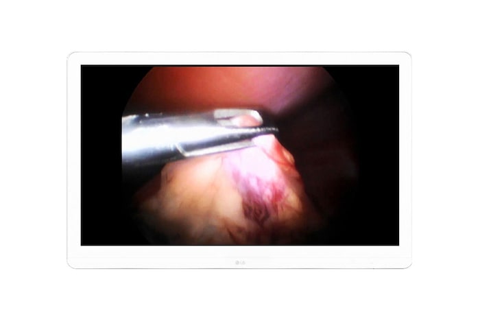 LG Monitor Quirúrgico 8MP, 27HJ710S-W