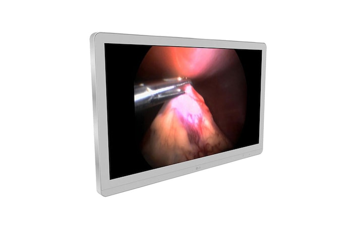 LG Monitor Quirúrgico 8MP, 27HJ710S-W