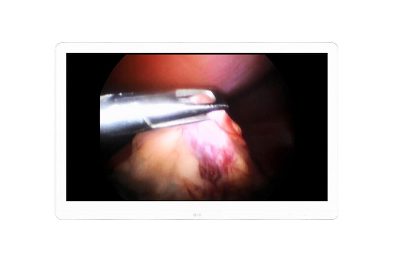 LG Monitor Quirúrgico 8MP, 27HJ710S-W