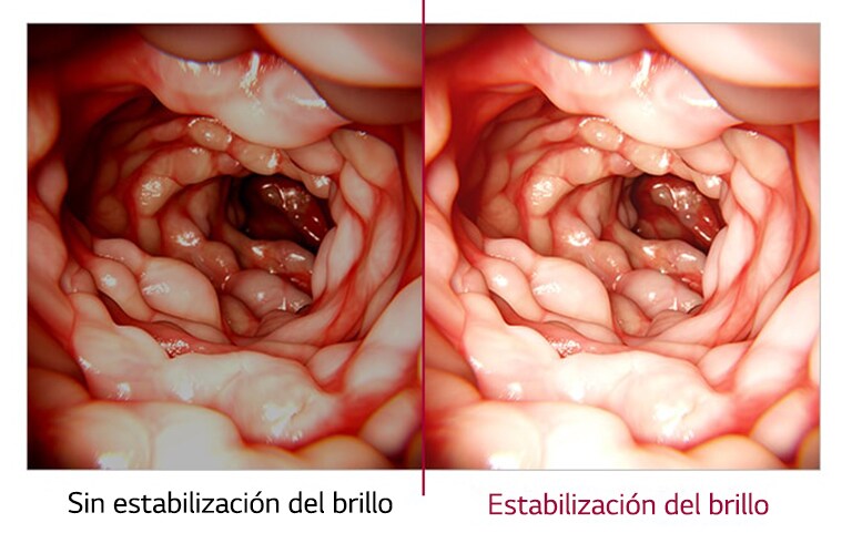 Sin estabilización del brillo comparado con Estabilización del brillo