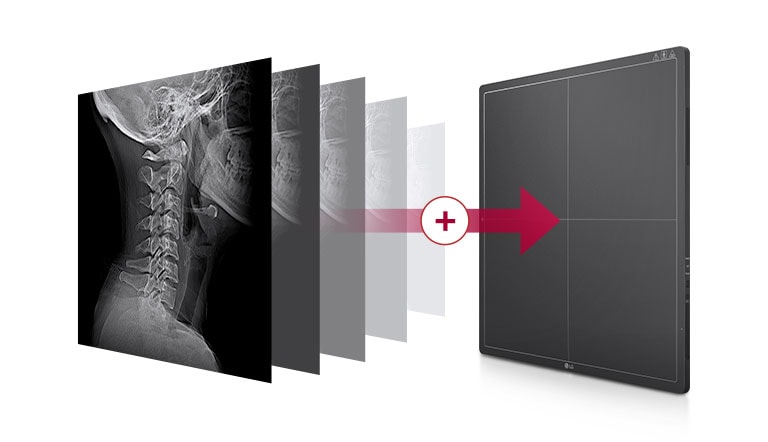 Una memoria incorporada que almacena automáticamente las imágenes tomadas en el detector, hasta 200 imágenes