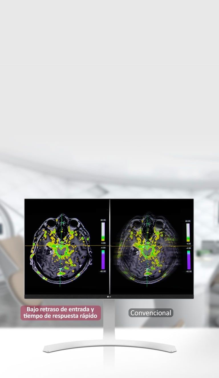 Tiempo de respuesta rápida