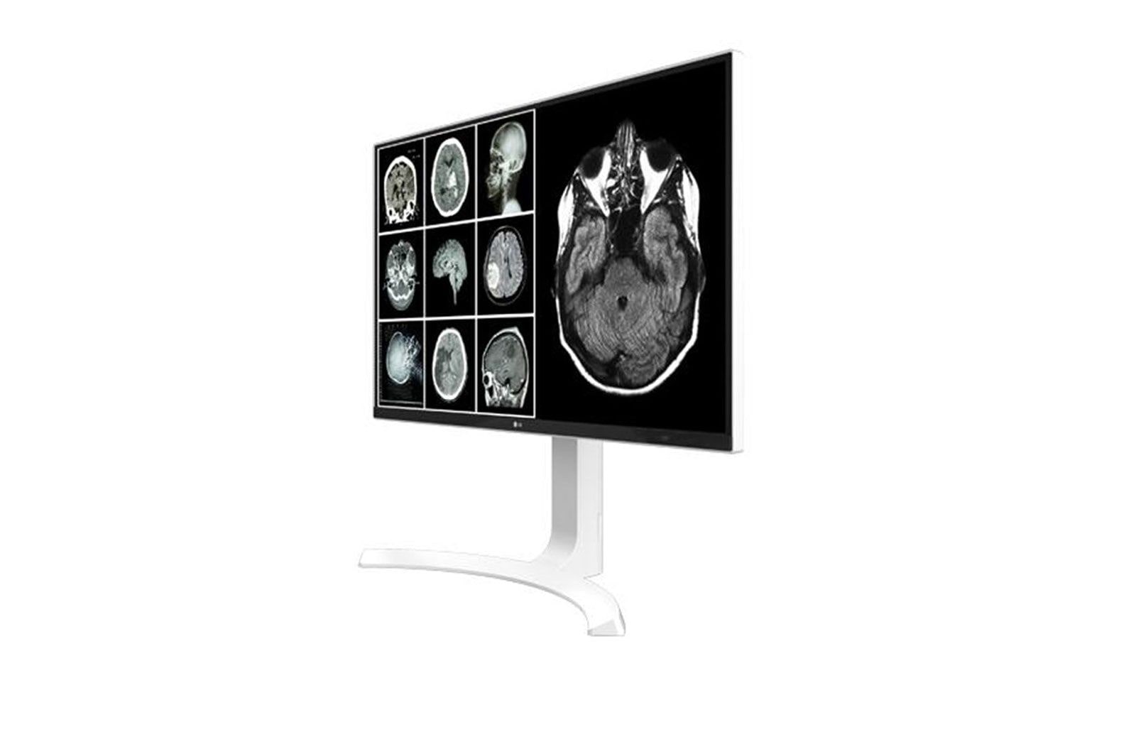 LG Monitor Clinico 8MP, 27HJ712C-W