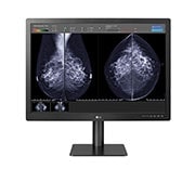 LG Monitor de Diagnóstico para Mamografía IPS 12MP de 31'' LG, 31HN713D-B