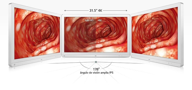 31.5" 4K: Full HD 4K, ángulo de visión amplia IPS: 178°