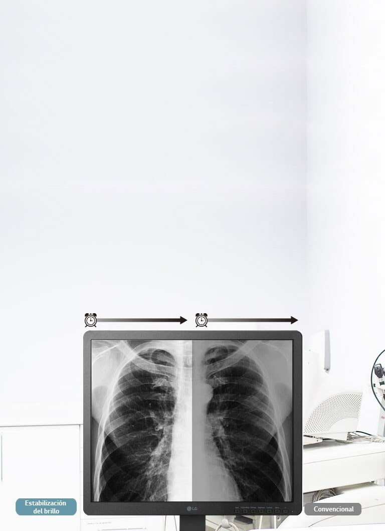 Estabilización de brillo