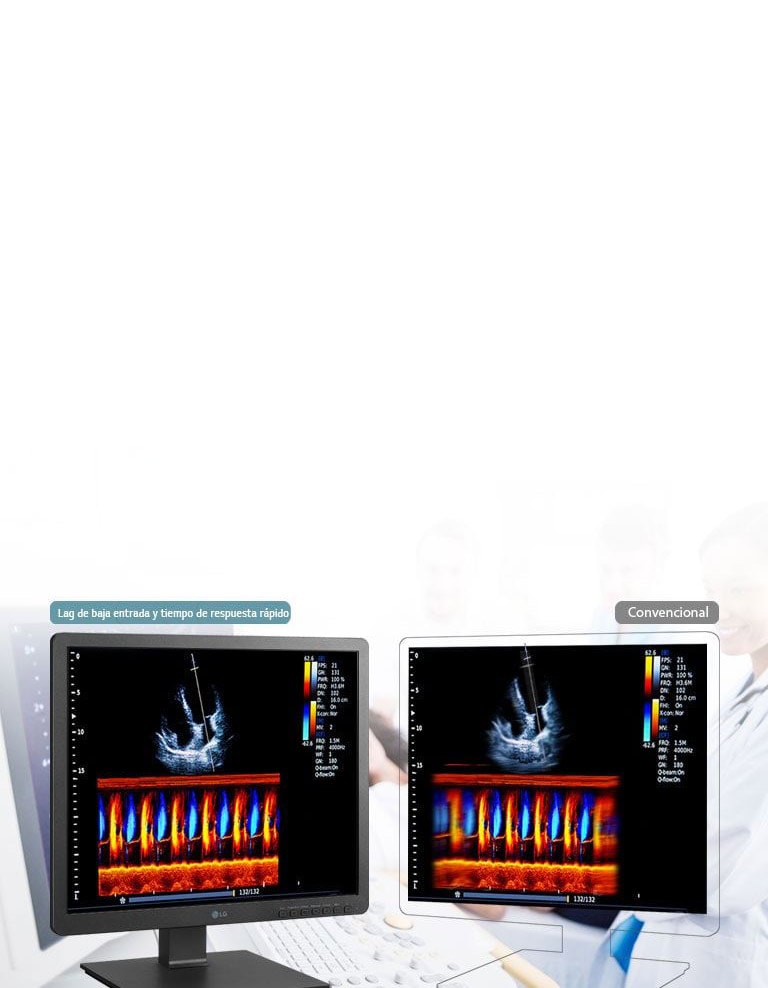 Tiempo de respuesta rápido