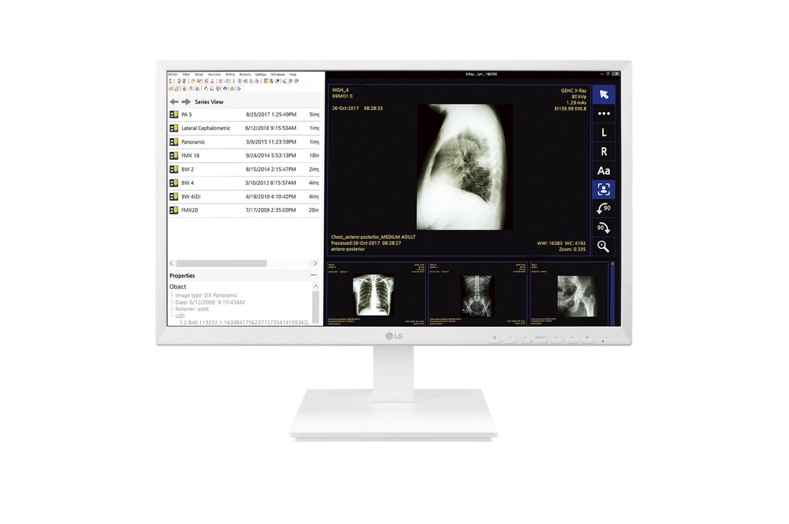 Monitor LG 24” Medyczny Monitor IPS Full HD Thin Client 24CK560N  24CK560N-3A - widok z przodu