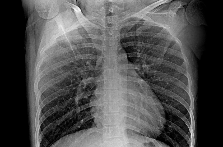 LG DXD — wysoka rozdzielczość i czyste obrazy diagnostyczne