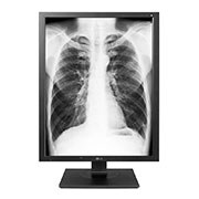 21&#34; Monitor diagnostyczny 3MP 21HK512D-B - widok z przodu