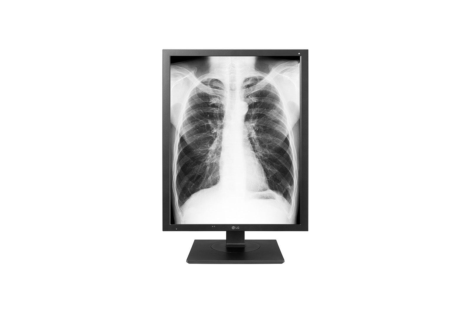 21&#34; Monitor diagnostyczny 3MP 21HK512D-B - widok z przodu