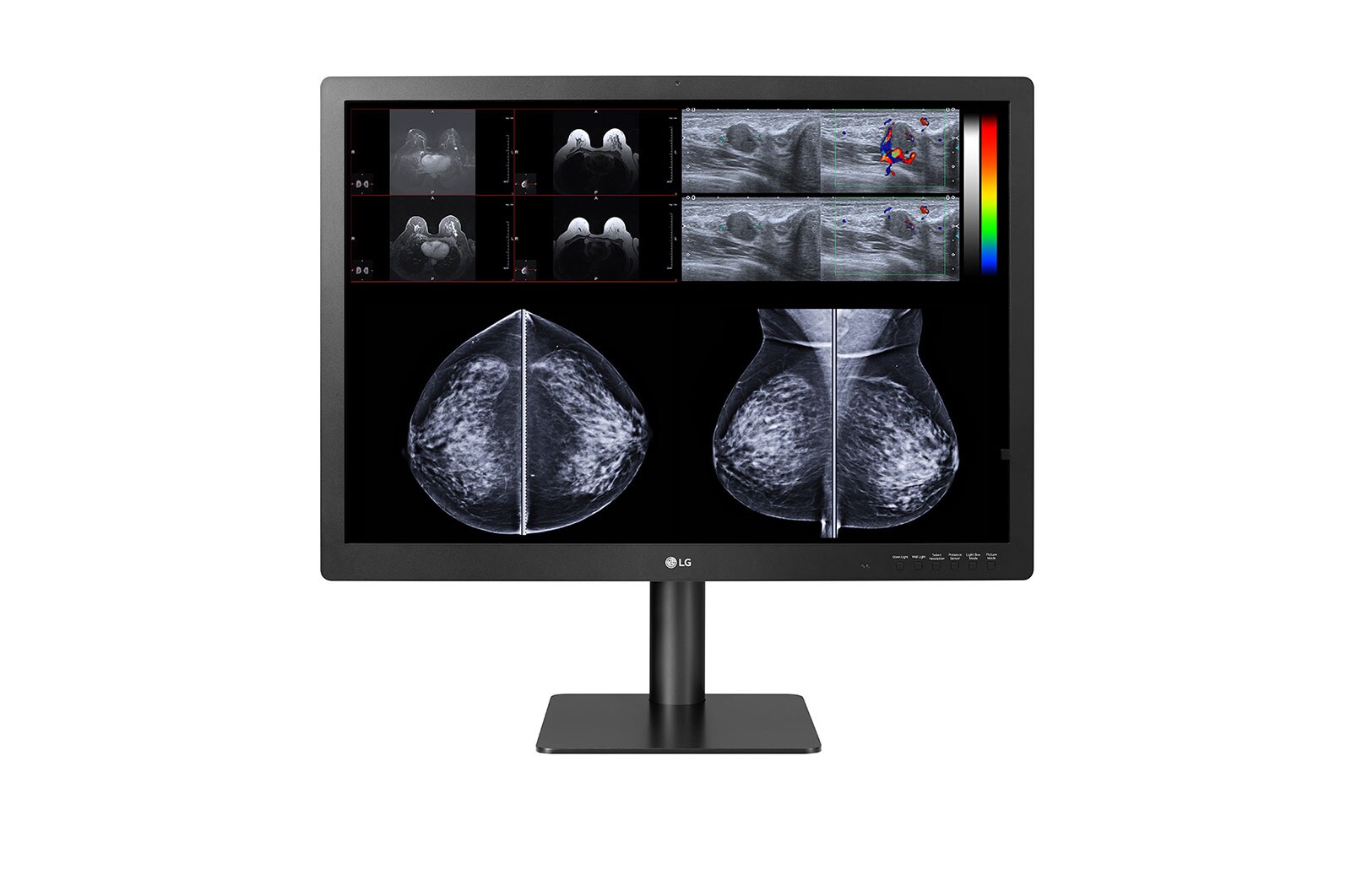 LG 31” Monitor diagnostyczny 12Mpix, 31HN713D