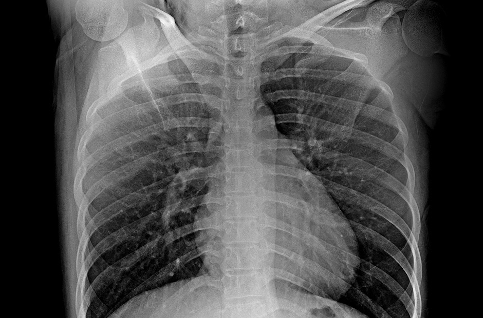 LG DXD — wysoka rozdzielczość i czyste obrazy diagnostyczne