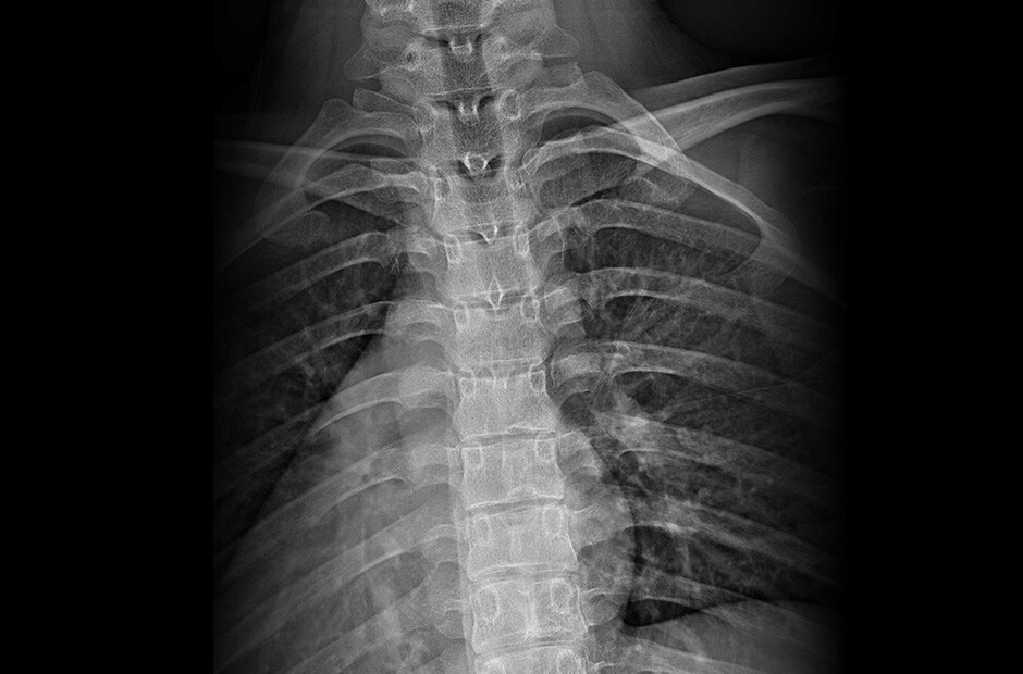 LG DXD — wysoka rozdzielczość i czyste obrazy diagnostyczne