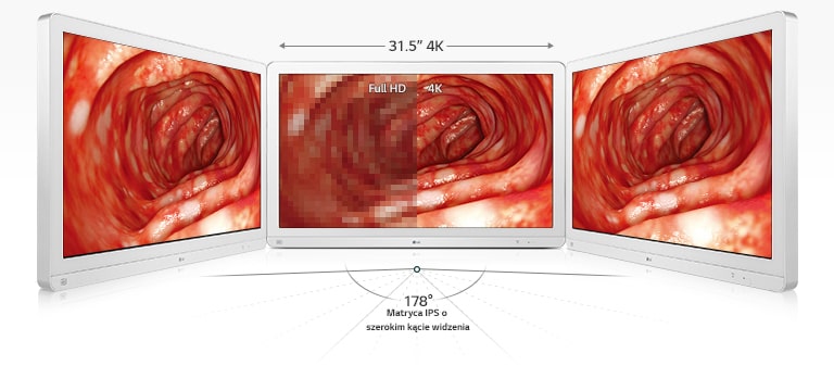 31,5” 4K / Full HD / 4K  /178° / Matryca IPS o szerokim kącie widzenia