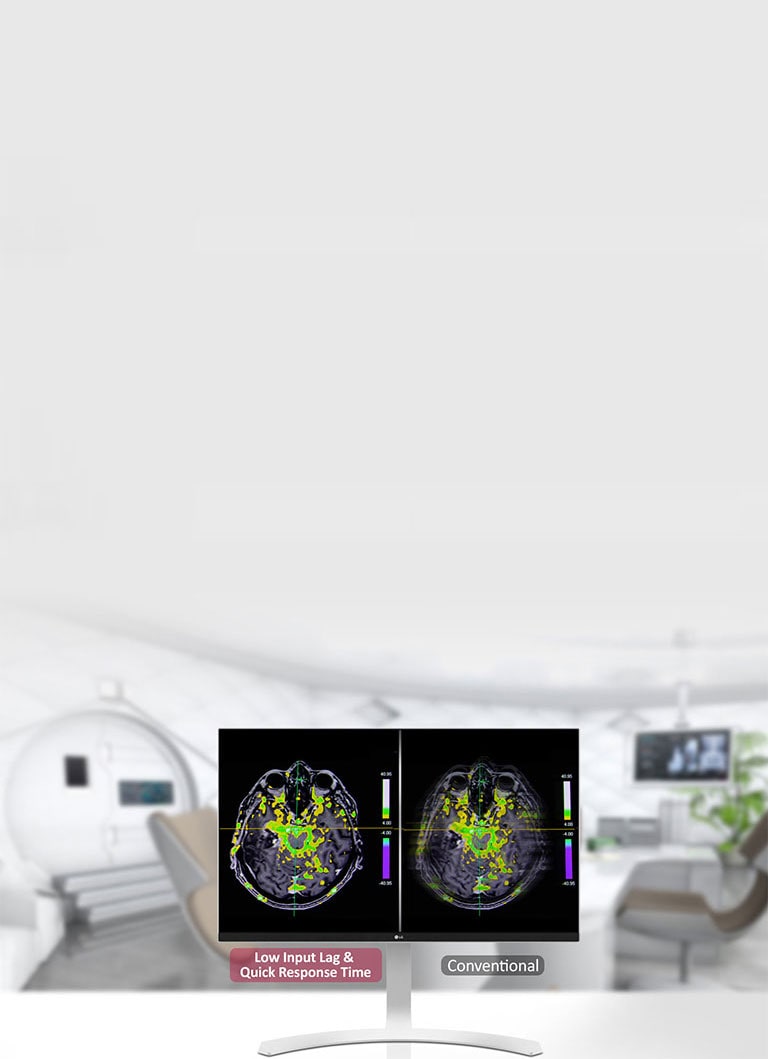 Tryb Dynamic Sync i krótki czas reakcji <br>1