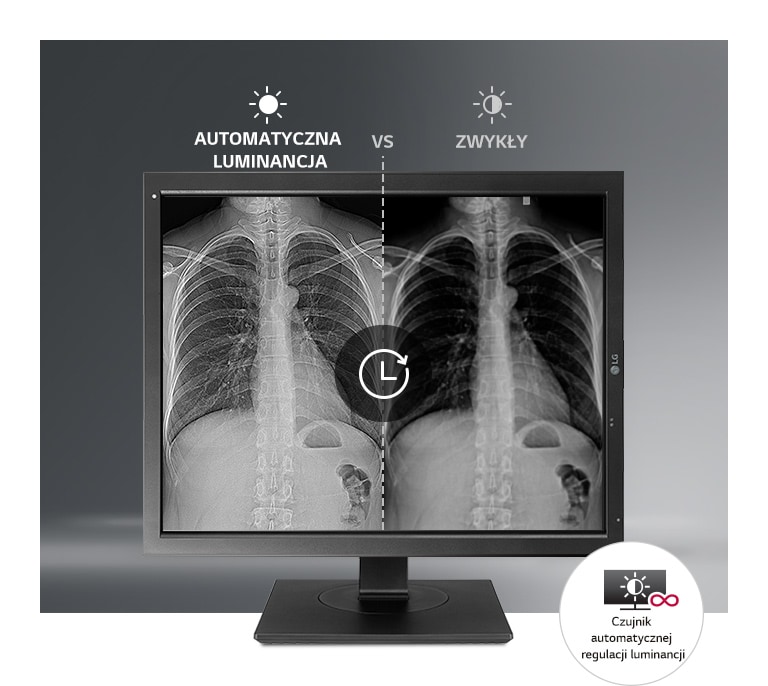 Automatyczna stabilizacja jasności1