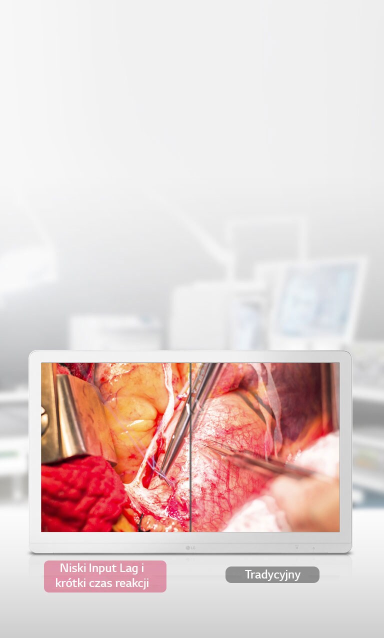 Tryb Dynamic Sync i krótki czas reakcji1