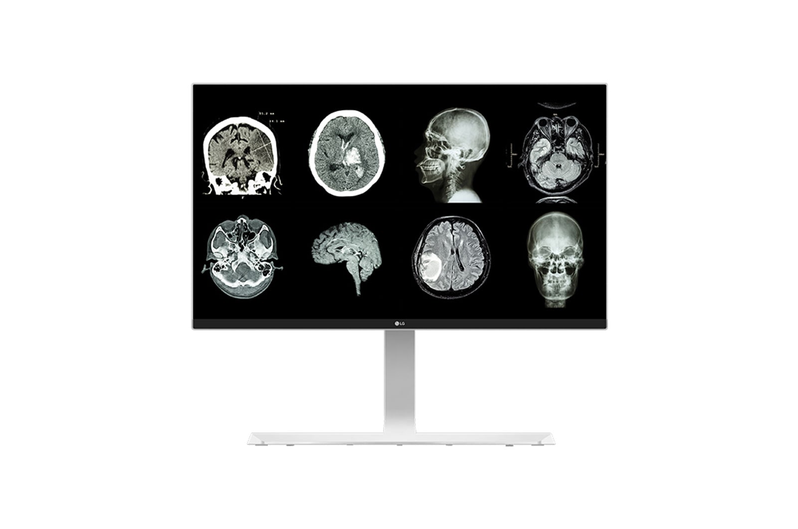 27” Medyczny monitor przeglądowy LG 8MP 27HJ712C-W - widok z przodu