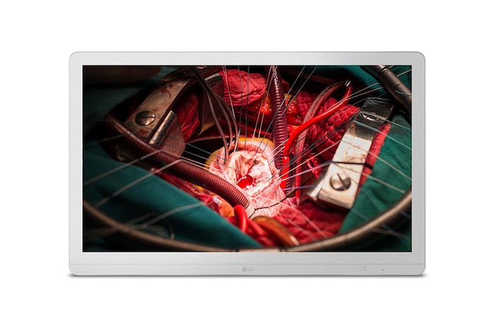 LG 27” Medyczny Chirurgiczny 4K, 27HJ710S-W