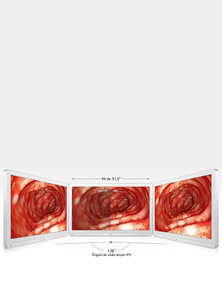 Precisão avançada com vista ampla