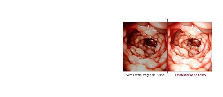 Estabilização de brilho