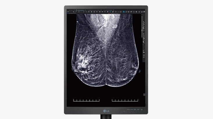 تتميز LG 21HQ613D بمستشعر الإضاءة التلقائي الذي يحدد سطوع الشاشة بشكل صحيح للإضاءة المحيطة.