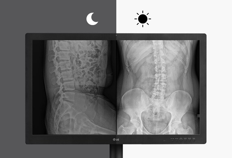 يضمن سطوع الشاشة