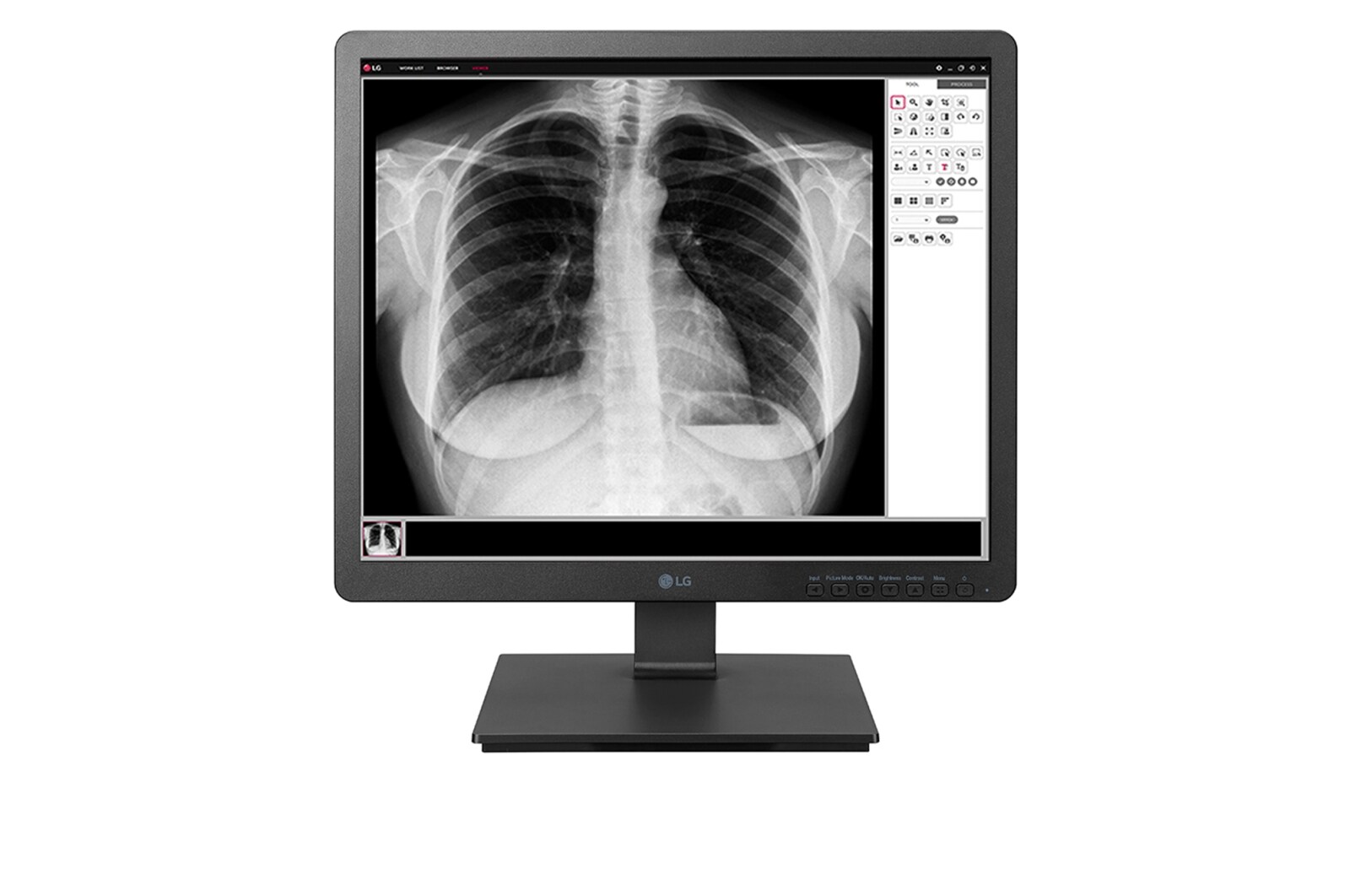 Front view of LG 19.3&#39;&#39; 1.3MP IPS Clinical Review Monitor 19HK312C-W