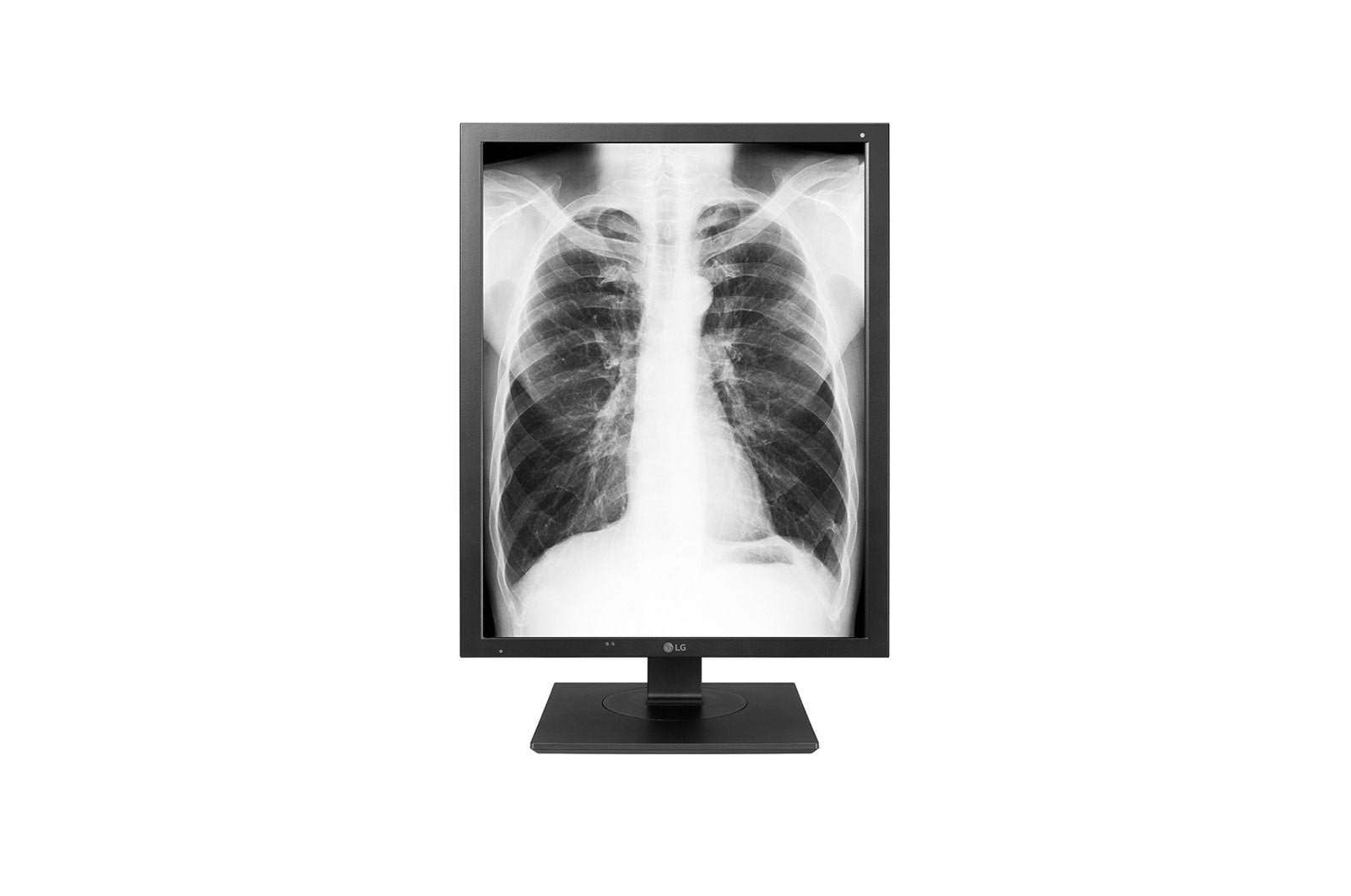Front view of 21.3” High Brightness (2048 x 1536) 3MP Color IPS Diagnostic Monitor 21HK512D-W