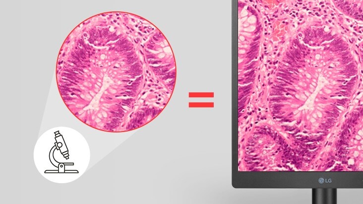 With Pathology mode, this diagnostic monitor provides image clarity and accuracy as if you were looking at a microscope.	