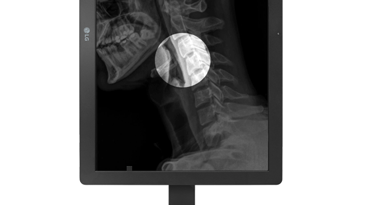 24HR513C features the Focus View Mode which highlights specific parts of the medical image. Users can easily select and focus on areas of concern while darkening the rest of the screen.