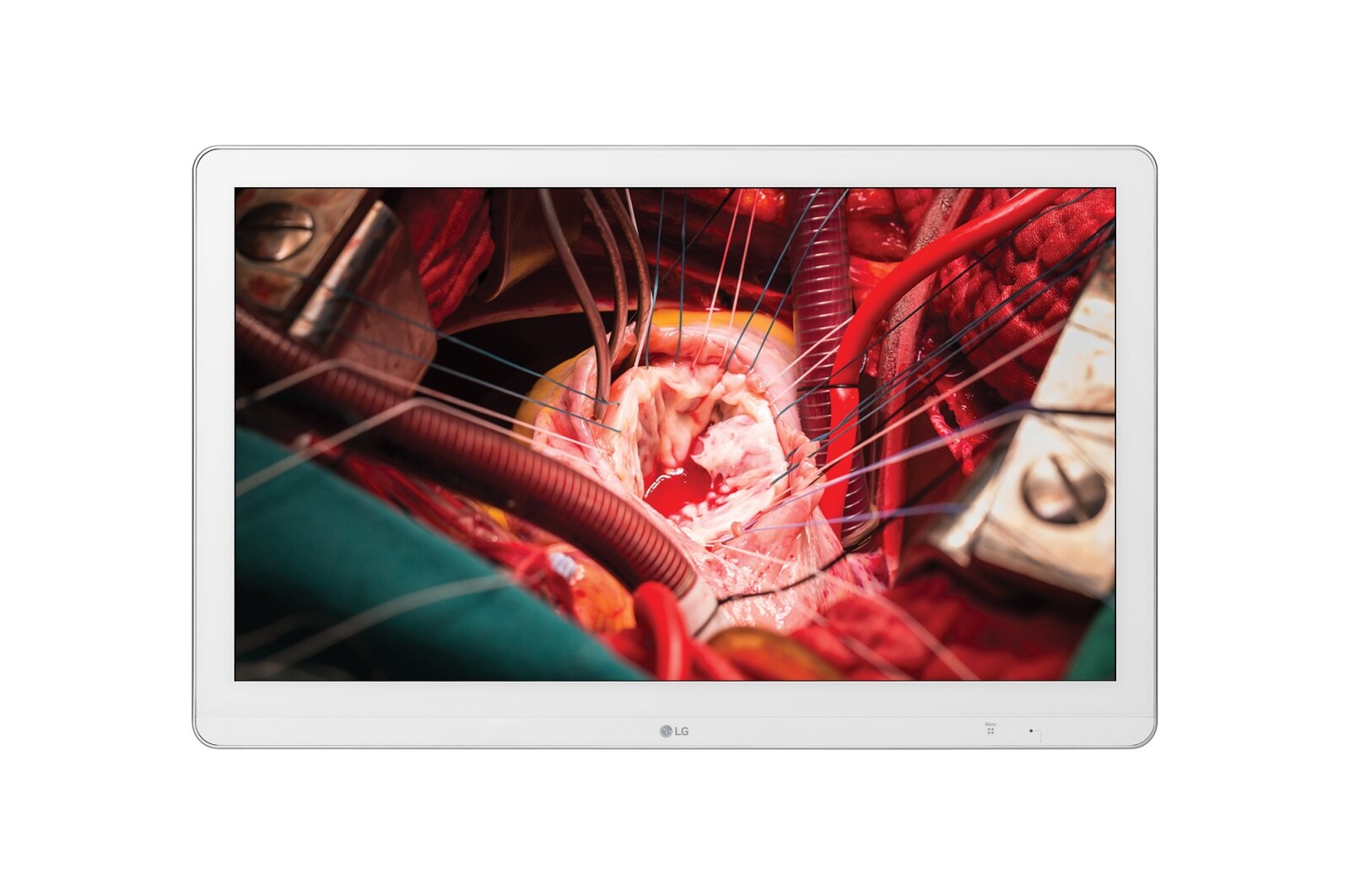 Front view of LG Full HD Surgical Monitor 27HK510S-W