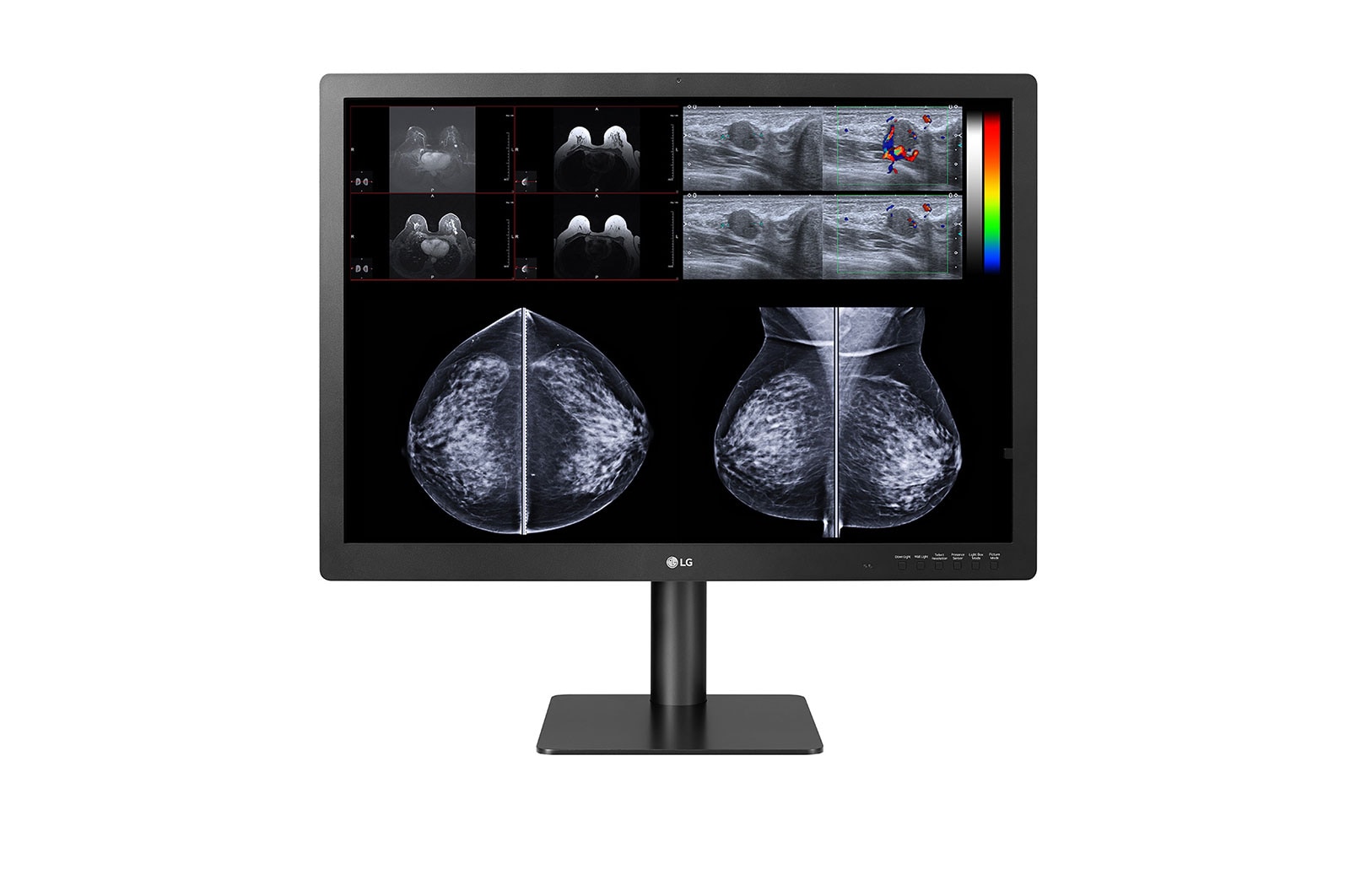 LG 31” 12MP (4200x2800) IPS Diagnostic Monitor for Mammography with Multi-resolution Modes, Pathology Mode, Self-calibration, Focus View, PBP and Dual Controller, 31HN713D-W