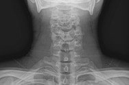 X-ray image 1.