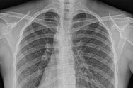 X-ray image 2