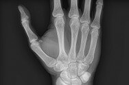 X-ray image 4